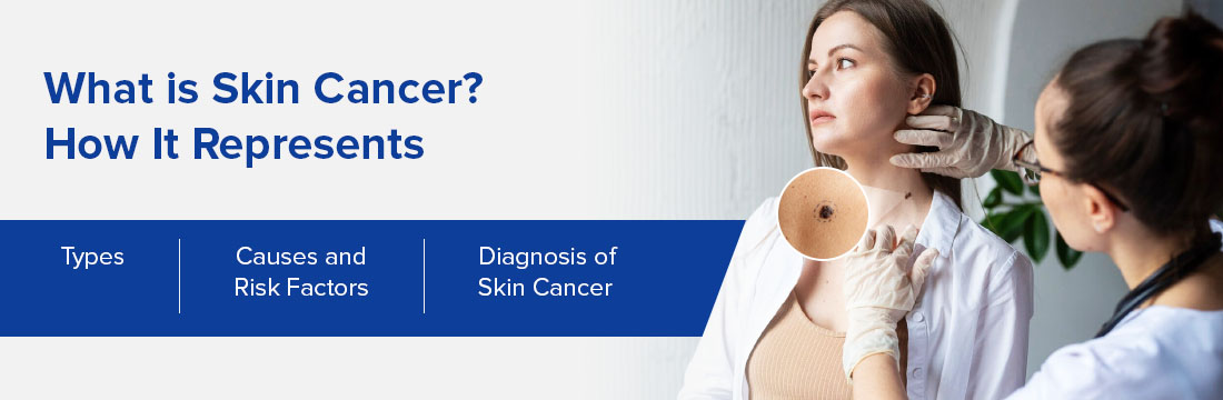 What is Skin Cancer? How It Represents